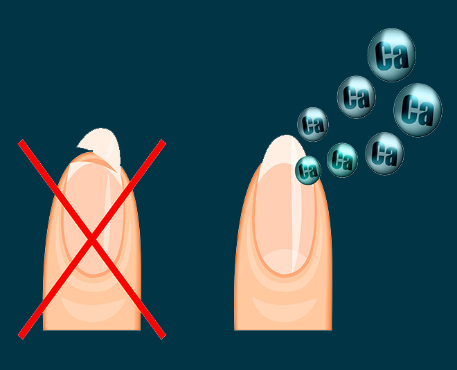 कमजोर नाखून brittle nail